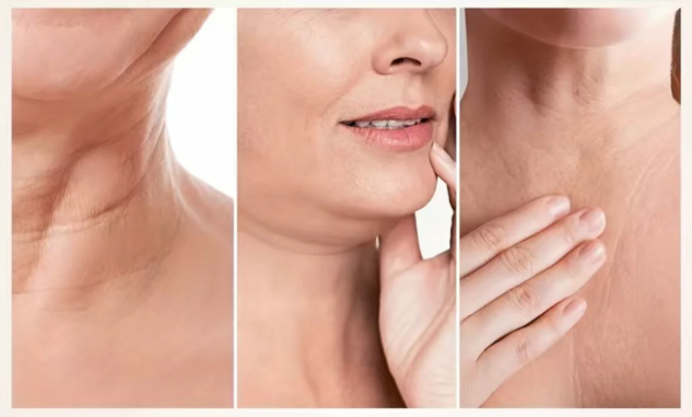 How to Fix Tech Neck Lines Fast: Proven Steps for Smoother Skin