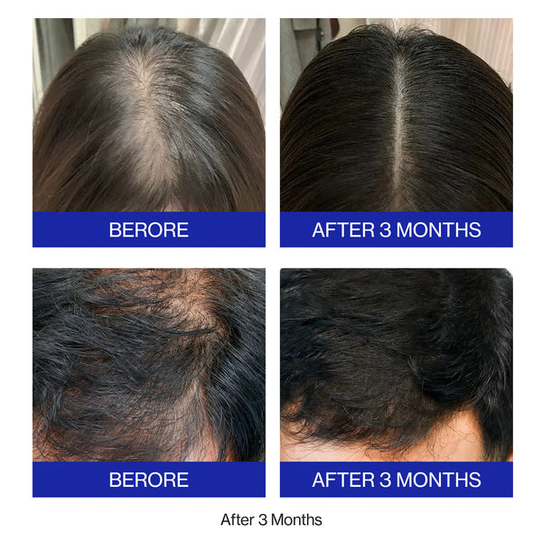 Z:SEA Anti-hair loss essence